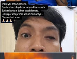 Desta Jalani Operasi Mata Usai Terkena Bola Padel, Ungkap Penyebab dan Kondisi Terkini